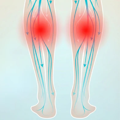 Diagrama de circulação nas pernas com e sem inchaço